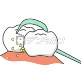 歯垢を取る歯間ブラシ by mocaco