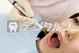 患者さんの歯の治療 女性