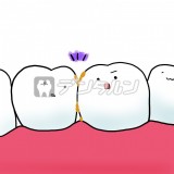 歯と歯の間に、みがき残しの汚れが残っていて気になっている歯